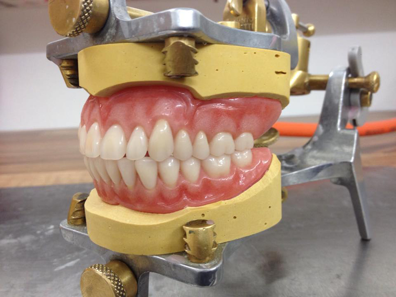 false teeth