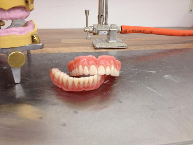 false teeth