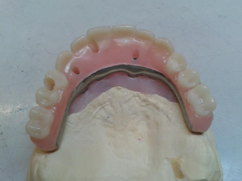 false teeth