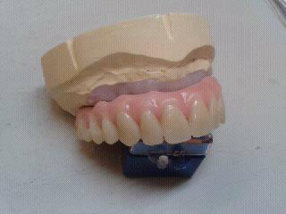 false teeth