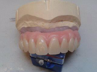 false teeth